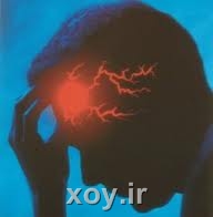 یک معجون جادویی برای تسکین سردرد xoy.ir وبلاگ خبری خوی