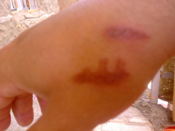 ده ستيكي سوتاو