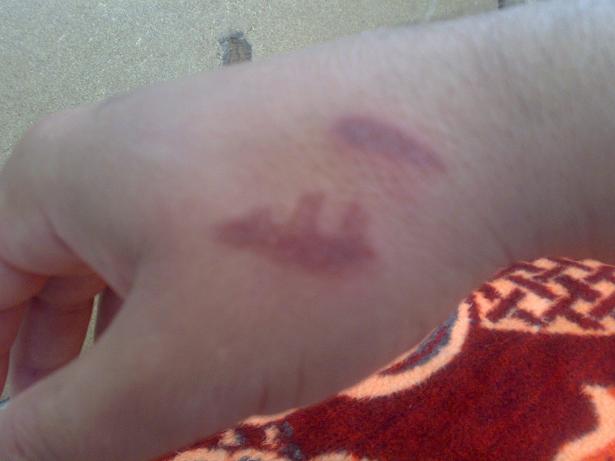 ده ستم به بو خاري ئاوي سه ما وه ر سوتا و الله ده ر هات