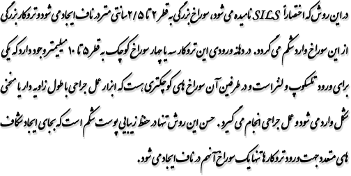 در این روش که اختصاراً SILS نامیده می شود ، سوراخ بزرگی به قطر 2 تا 5/2 سانتی متر در ناف ایجاد می شود و تروکار بزرگی از این سوراخ وارد شکم می گردد. در دهانه ورودی این تروکار سه یا چهار سوراخ کوچک به قطر 5 تا 10 میلیمتر وجود دارد که یکی برای ورود تلسکوپ و لنز است و در طرفین آن سوراخ های کوچکتری هست که ابزار عمل جراحی با طول زاویه دار یا منحنی شكل وارد می شود و عمل جراحی انجام می گیرد . حسن این روش تنها در حفظ زیبایی پوست شکم است که بجای ایجاد شکاف های متعدد جهت ورود تروکار ها تنها یک سوراخ آنهم در ناف ایجاد می شود.
