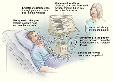 http://s2.picofile.com/file/7697216341/Ventilator_03.jpg