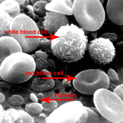 گلبول های قرمز ، گلبول های سفید و پلاکت های خون