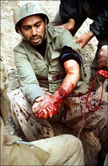 رزمنده مجروح ایرانی-عکسهای جنگ تحمیلی ایران و عراق-دفاع مقدس