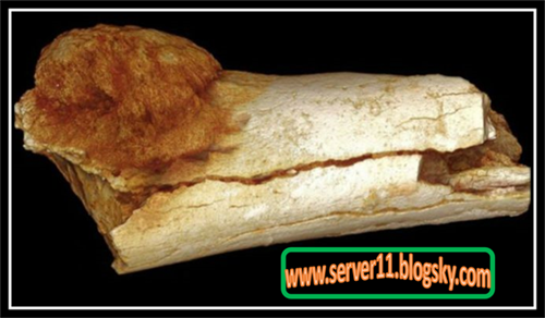 کشف آثار سرطان در استخوان‌های ۱.۷ میلیون سال اجداد انسان
