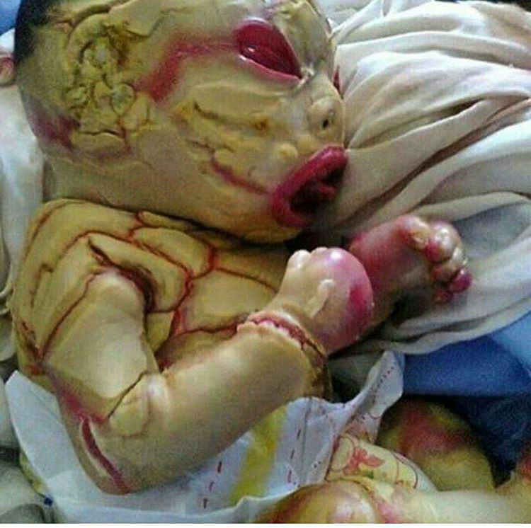 ictiosis - photo by Negarin Akbari ictiosis - photo by Negarin Akbari