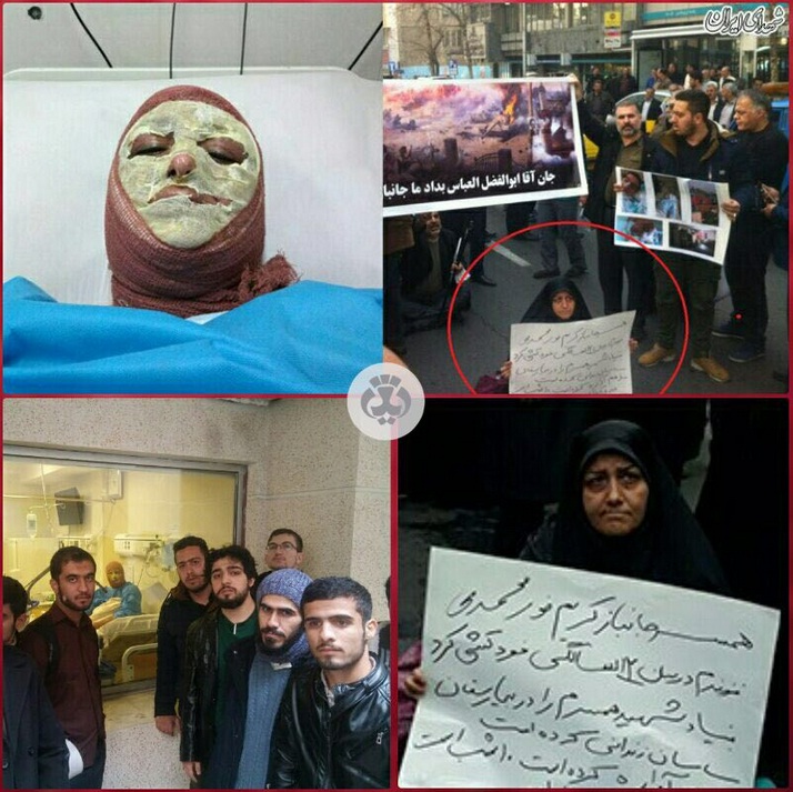 خودسوزی همسر جانباز در اعتراض به عدم رسیدگی بنیاد شهید!
